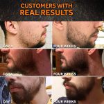 Minoxidil Para Barba Y Bigote - Crecimiento Facial De Hasta 8 Meses