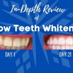 SNOW Teeth Whitening Complete Kit