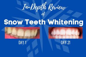 SNOW Teeth Whitening Complete Kit